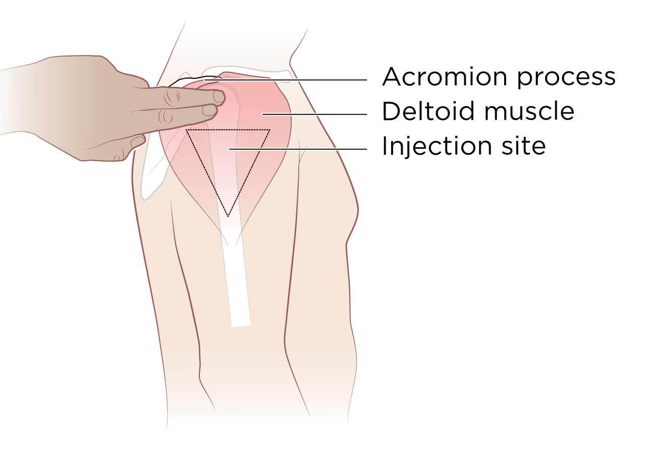 How To Do A Deltoid Injection For Trt Full Guide Demo The Trt Hub